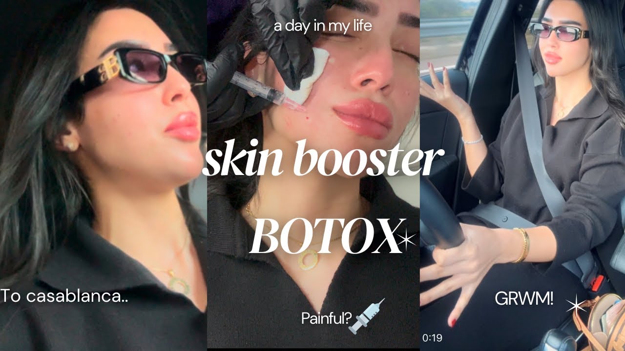 IT’S TIME FOR BOTOX💉”skin booster”| يلاه معايا ندير بوطوكس و ابرة المشاهير😍