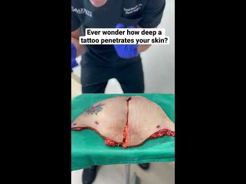Ever Wonder How Deep A Tattoo Penetrates Your Skin Mommymakeover Liposuction Tummytuck
