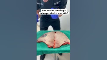 Thumbnail of Ever wonder how deep a tattoo penetrates your skin?!😱 #mommymakeover #liposuction #tummytuck