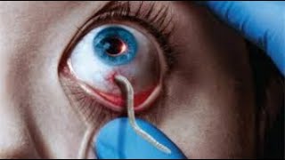 It Moves MrBallen’s Medical Mysteries