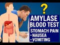 Amylase Blood Test Explained | High & Low Amylase Causes & Results