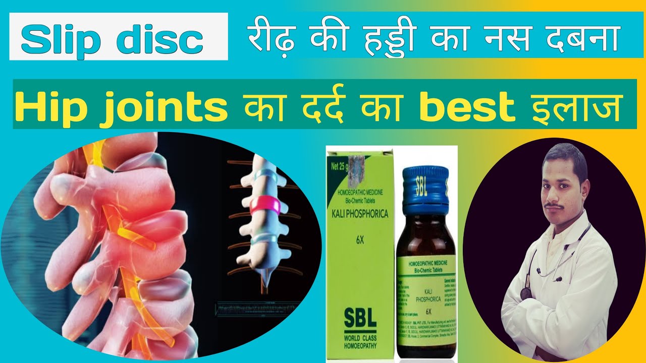 Slip disc Homeopathic Treatment।Spinal cord का नस दबना। Slip disc के