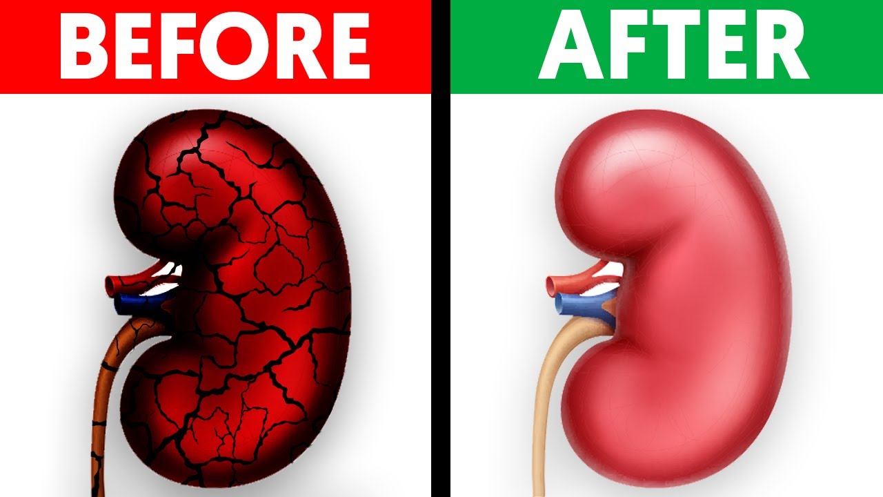 7 Superfoods That Will Boost Your Kidney Health - YouTube