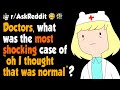 Doctors of Reddit, what is your "oh i thought that was normal?"