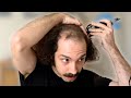 Balding curly hair man goes bald for first time