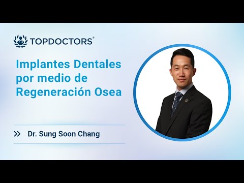 Implantes Dentales por medio de Regeneración Ósea