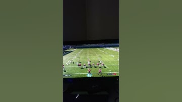 Madden 21 - The Best Man Defensive Scheme in Madden 21| #YoutubeShorts #Shorts