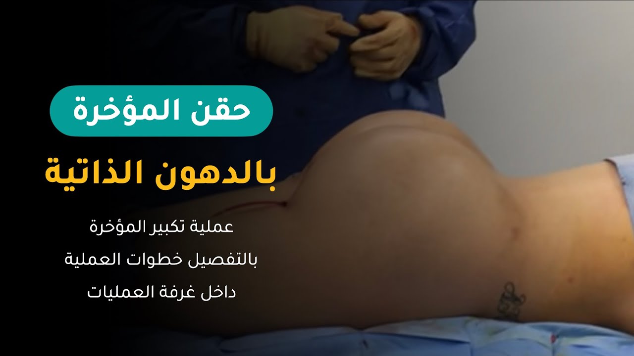 عملية تكبير المؤخرة في تركيا حقن المؤخرة بالدهون المؤخرة البرازيلية اثيكانا كلينك Youtube