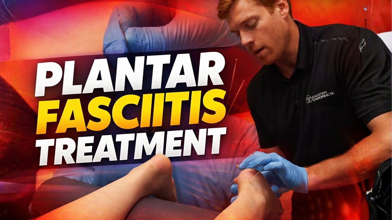 The Gold Standard for Plantar Fasciitis Relief │ Dry Needling, Shockwave & Chiropractic Adjustment