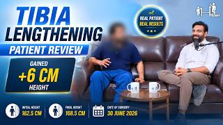 +6 CM Height Gain After Tibia Leg Lengthening Surgery in India | Patient Review | 162.5 to 168.5 CM