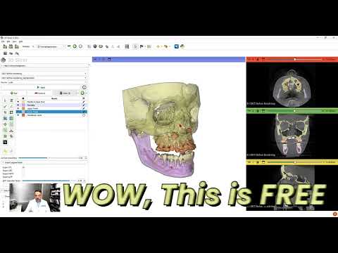 FREE AI CBCT Teeth Rendering in 3D Slicer Dr Wael Kanaan