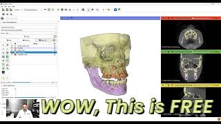 FREE AI CBCT Teeth Rendering in 3D Slicer Dr Wael Kanaan