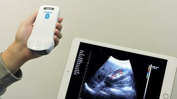 3 in 1 Single Head Portable Ultrasonic Scanner with WIFI/USB for IOS/Android/Windos Chinese Factory