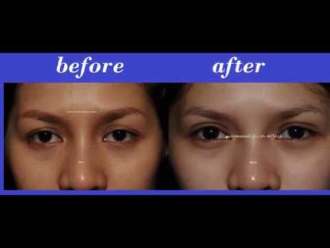 Bangkok Aesthetic Surgery Center