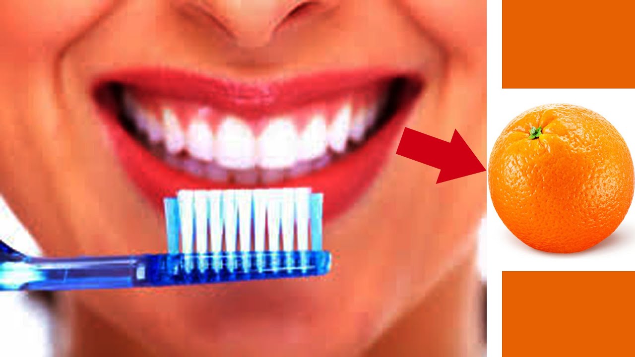 Magical Teeth Whitening home Remedy, Get whiten Teeth at home in 2