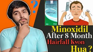 Why Am I Still Losing Hair After 8 Months of Minoxidil? 50 to 100 Hairs Shed Per Day 😥😥 | This iS...