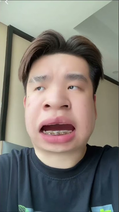 macam-macam jatuh