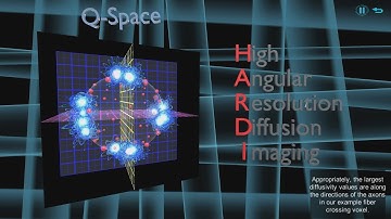 MRillustrated - Diffusion 3: HARDI & Q-Balls