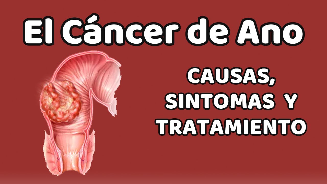 Quais sintomas do cancer anal