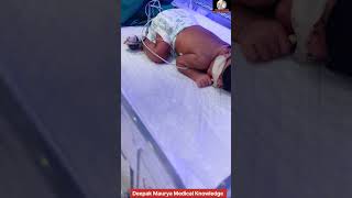 Newborn baby jaundice treatment by phototherapy.#newborn #jaundice #phototherapy #