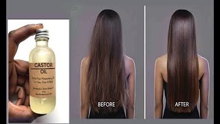 Most People Don't Know How To Use Castor Oil Correctly
