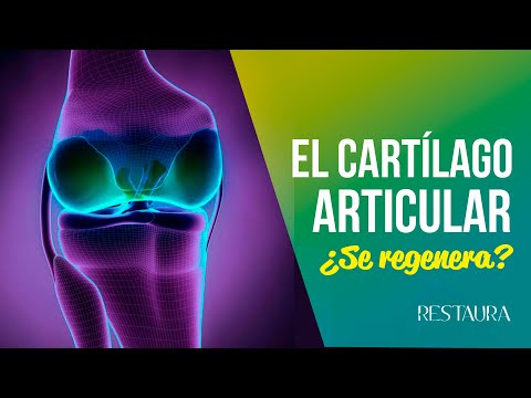 Vídeo: Vitaminas Y Suplementos Para La Cirugía De Reemplazo De Rodilla