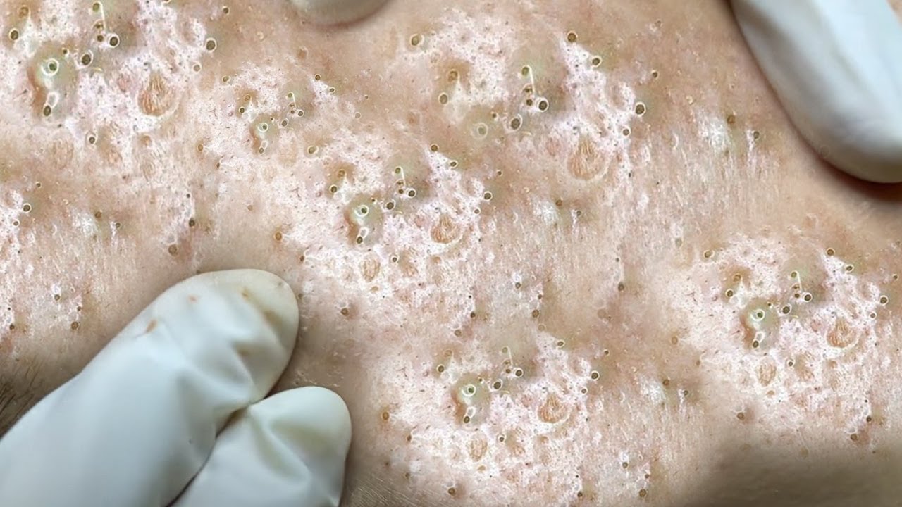 Satisfying video with Chung Vo Spa | 157