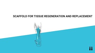 Unibo Patents Scaffold For Tissue Regeneration And Replacement