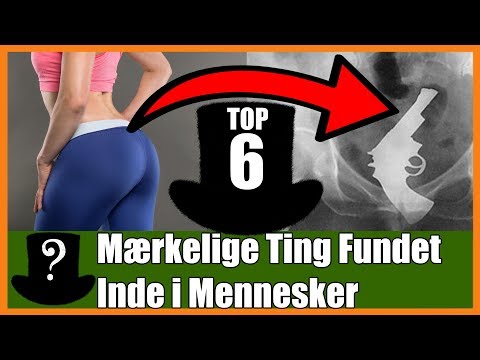 Video: Er Slangens år Heldigt For Mennesker?