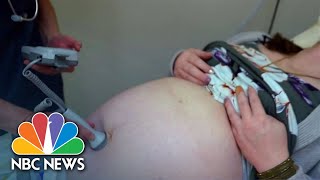 Nationwide, 36% Of Counties, Largely In The Midwest And South, Constitute 'Maternity Care Deserts'
