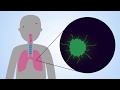 Immunotherapy using designer immune cells targeting infectious diseases