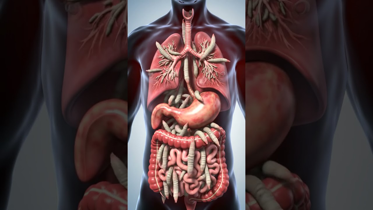 Watch Parasites Leave the Body | 3D Animation of Gut & Lung Detox