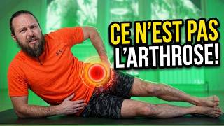 Douleur à la Hanche ? Ce n’est PAS de l’Arthrose ! (Auto-test)