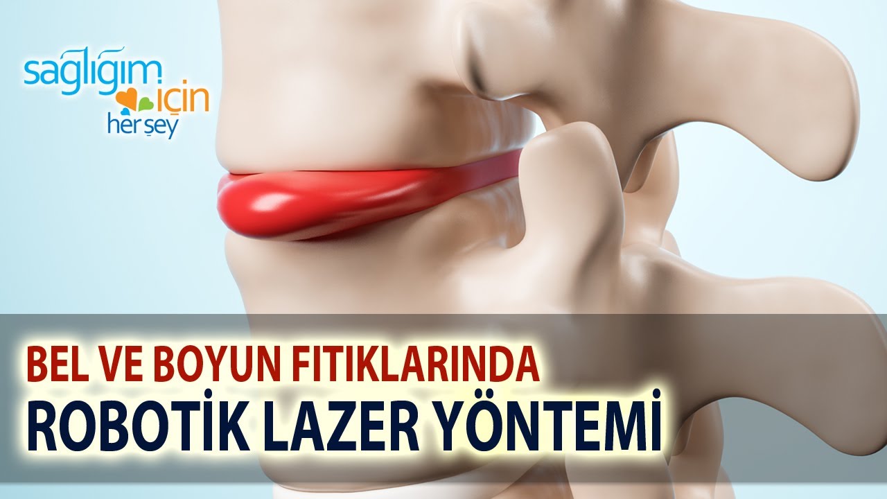 Bel ve Boyun Ağrılarının Tedavisinde Kullanılan Robotik Lazer Yöntemi