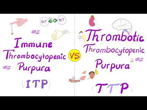 TTP overview and CTTP treatment