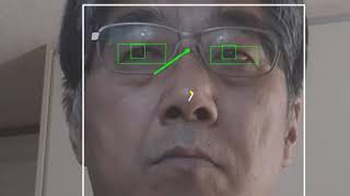 iris tracking
