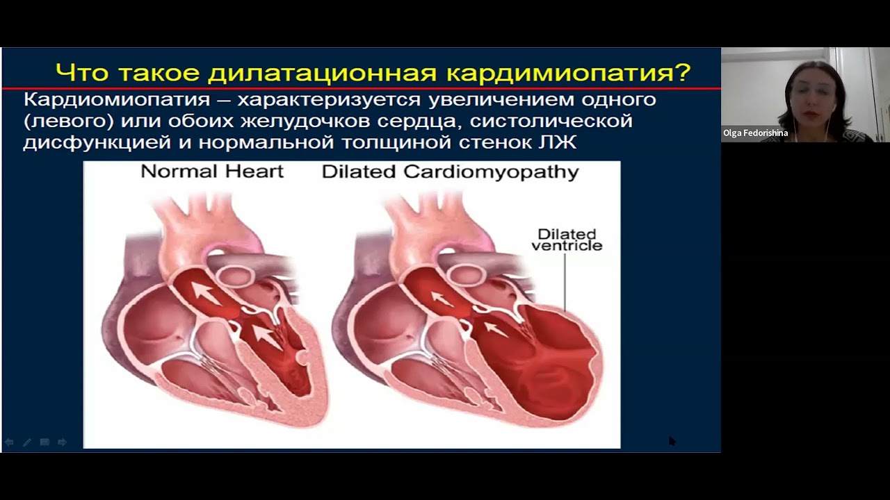 Лечение кардиомиопатии у кошек