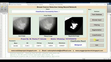 Matlab Project BREAST CANCER DETECTION Using Image Processing | BREAST CANCER DETECTION Using Matlab