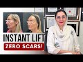 BOOK NOW: EndoLift Non-Surgical Facelift | All Your Questions Answered
