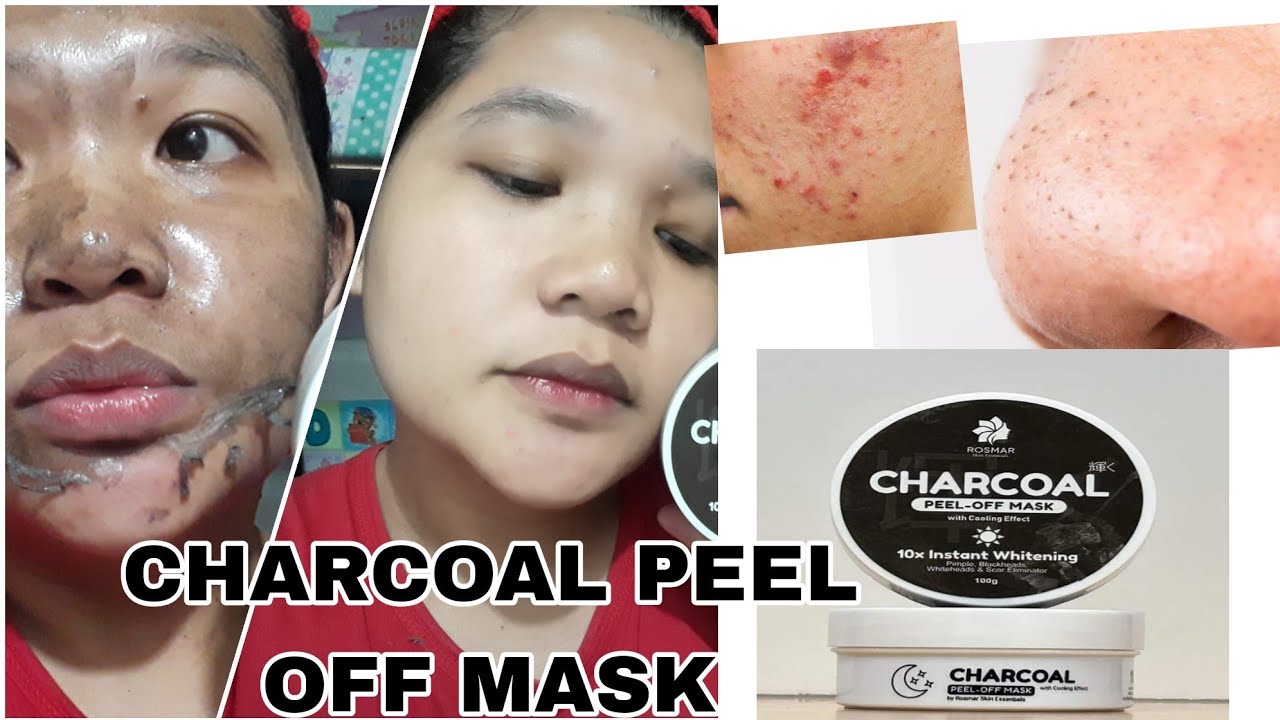 Rosmar charcoal peel off mask review!! YouTube