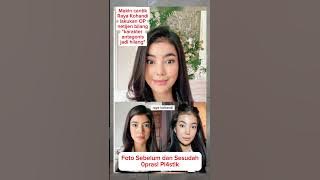 Raya kohandi makin cantik #shorts #rayakohandi #artis #operasiplastik #videoviral