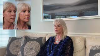 "No Filter Needed After My Deep Plane Facelift" | Plastic Surgery Patient Testimonial