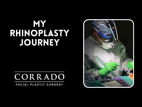 Video thumbnail: My Rhinoplasty Surgery: A Real Patient's Journey | Dr. Anthony Corrado · Dr. Anthony Corrado