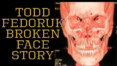 How Todd Fedoruk Completely Broke His Face Fightin...