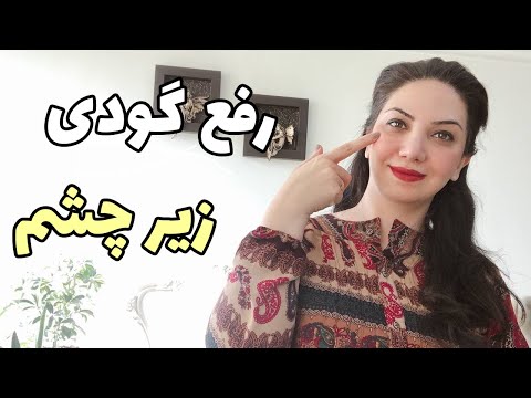 تصویری: 3 راه برای بازگرداندن گودی زیر چشم