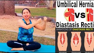 Abdominal Bulging Diastasis Recti or Hernia? Beginner Core Program to Fix Under 10 minutes!