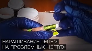 видео: Наращивание гелем на проблемных ногтях (трапециевидные глубоко посаженные ногти): практика / Маникюр картинка: Наращивание гелем на проблемных ногтях (трапециевидные глубоко посаженные ногти): практика / Маникюр