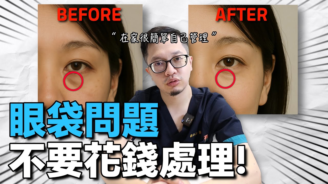 開始有眼袋的問題？必須看這影片！在家每天花5分鐘輕鬆處理。