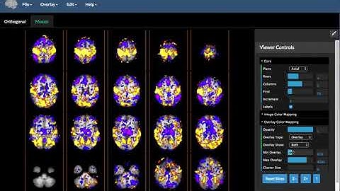 BioImage Suite Web Introduction Video
