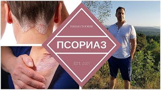 Псориаз. Истинные причины Псориаза и лечение